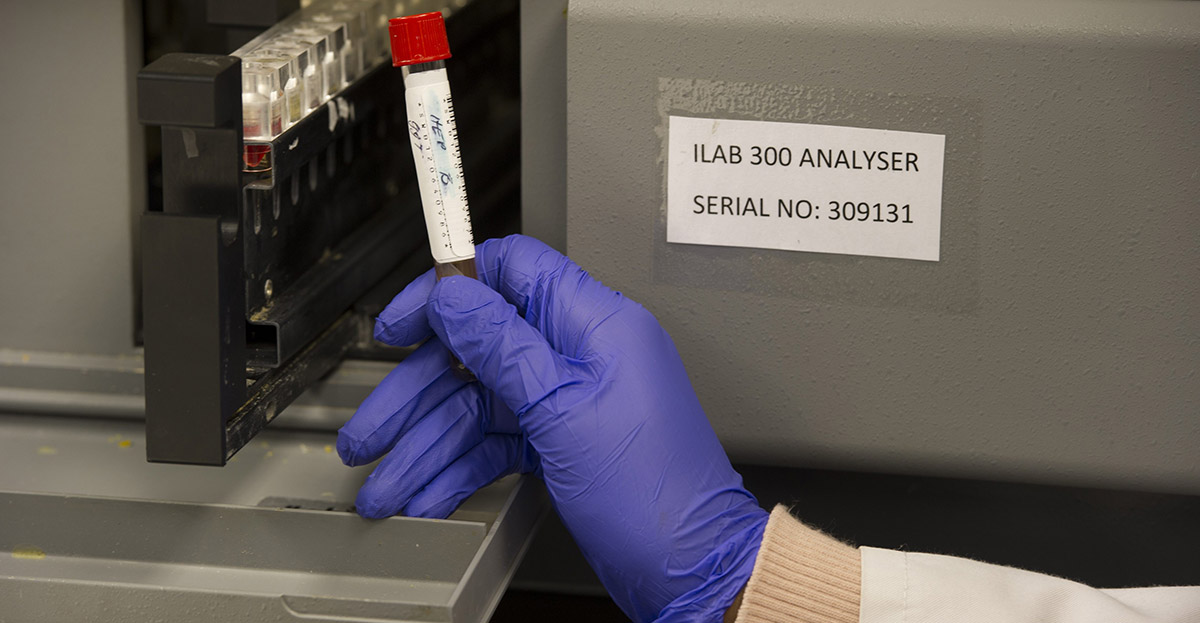 Which Metals are Used in Medicine? Anglo American